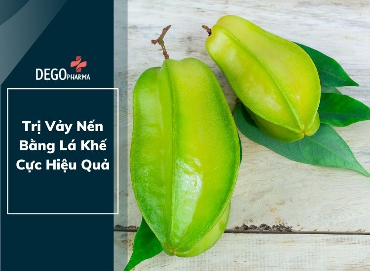 Hướng dẫn cách chữa vảy nến bằng lá khế tại nhà