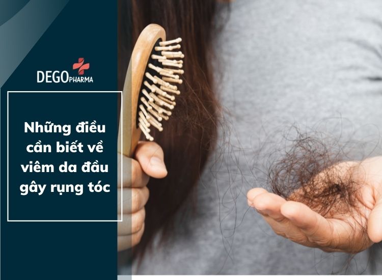 Những điều cần biết về viêm da đầu gây rụng tóc