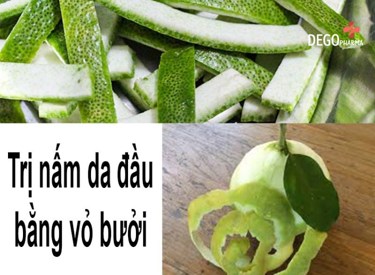 nấm da đầu có lan xuống mặt