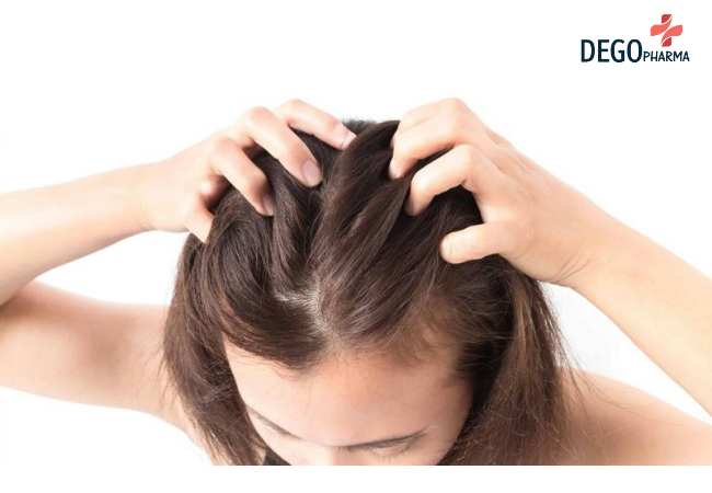cách chữa nấm da đầu tại nhà
