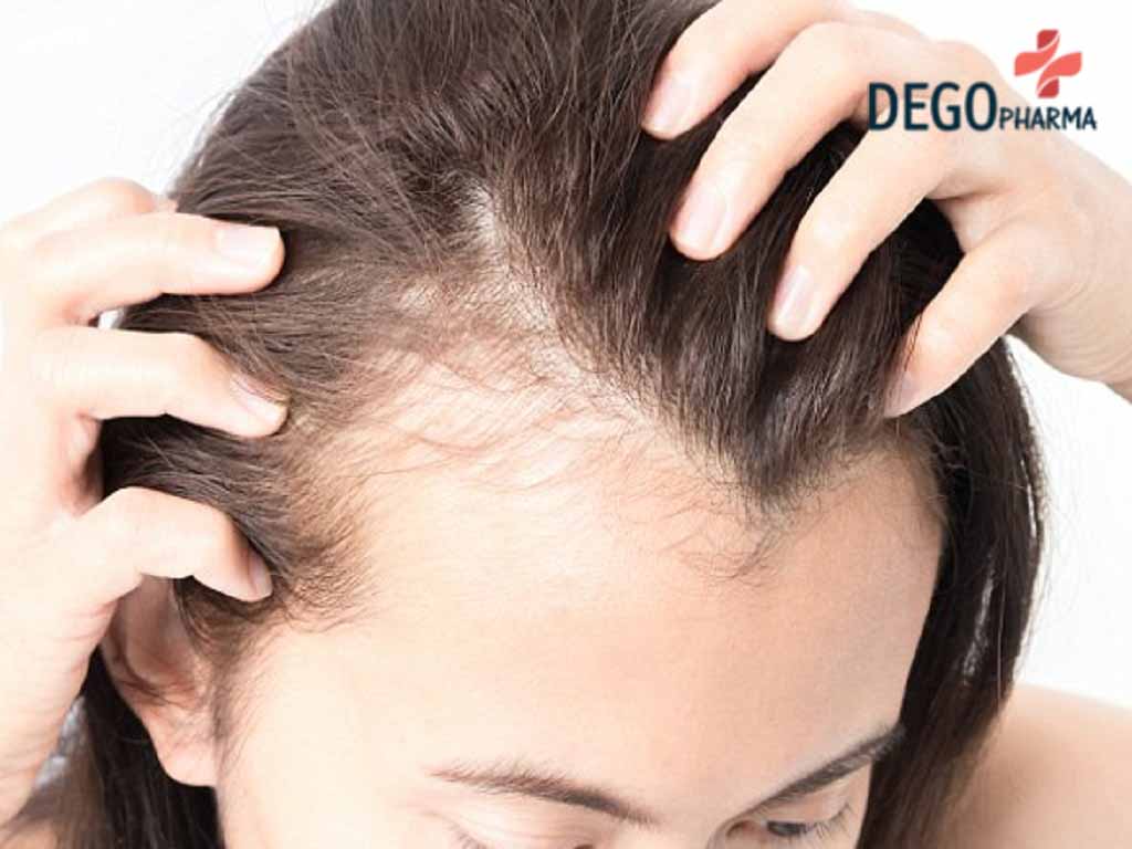 Lý Do Tóc Bị Gàu và Giải Pháp Giúp Cải Thiện Hiệu Quả – DERMEDIC VIETNAM