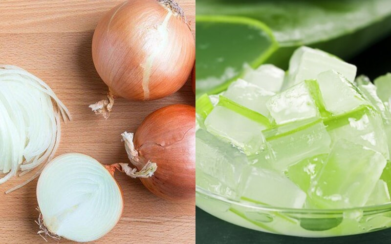 Trị rụng tóc bằng hành tây 
