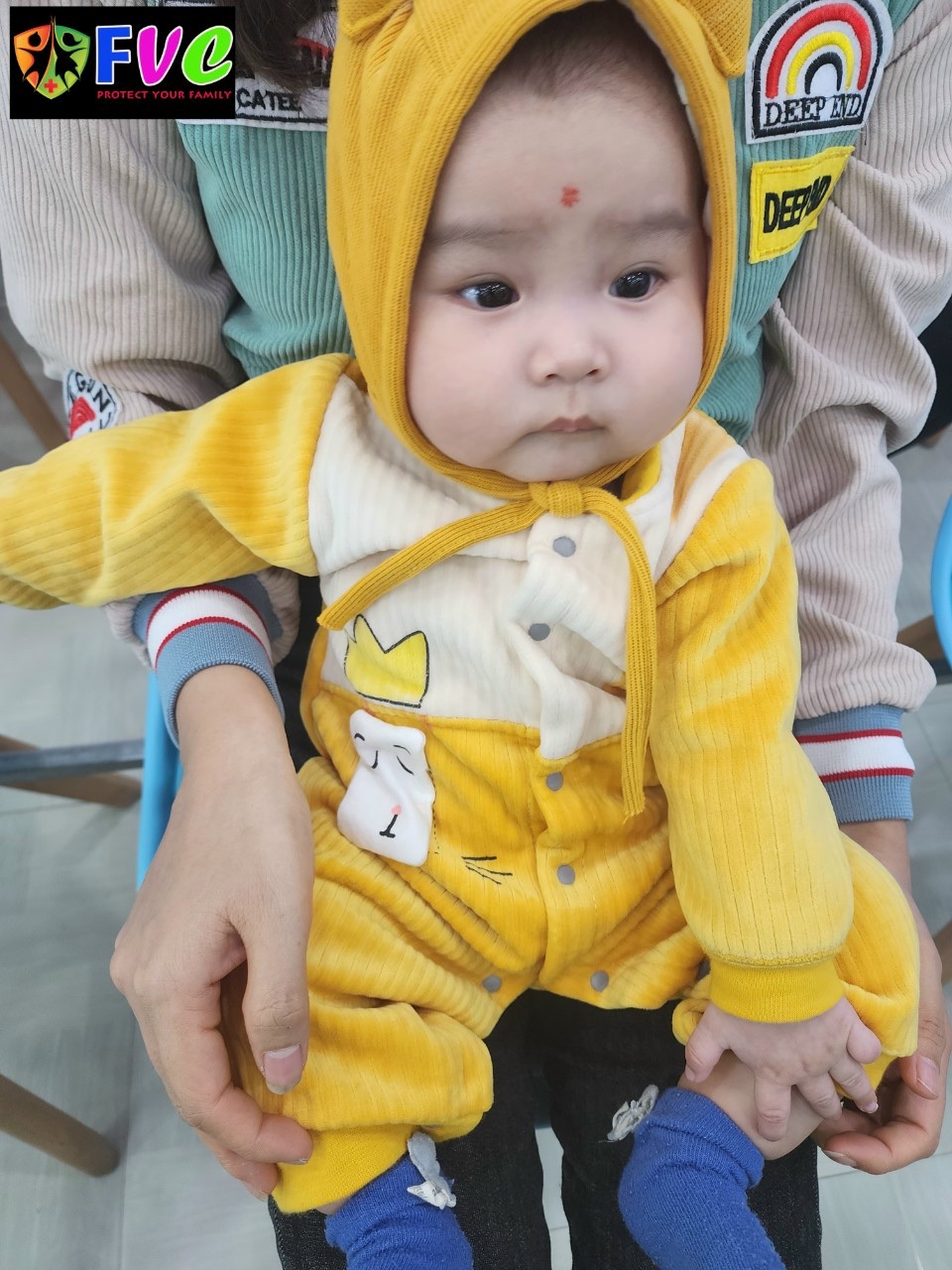 Tật dính thắng lưỡi ảnh hưởng thế nào với trẻ?