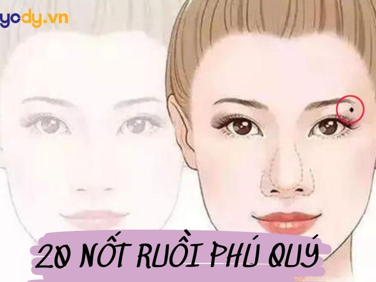 20 Nốt Ruồi Phú Quý Mang Tài Lộc Giàu Sang Không Được Xóa