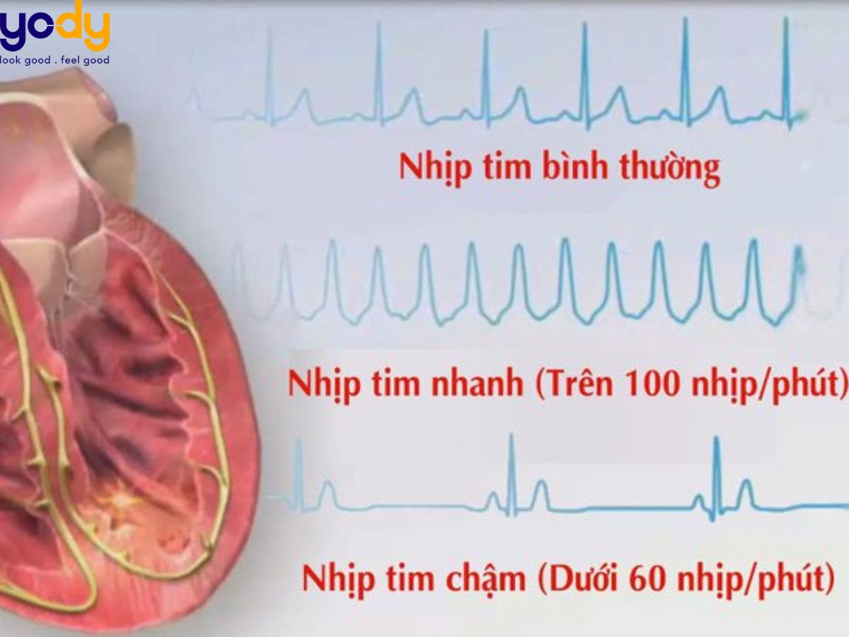 Nhịp tim bình thường là bao nhiêu? Nhịp tim theo độ tuổi với người khỏe mạnh