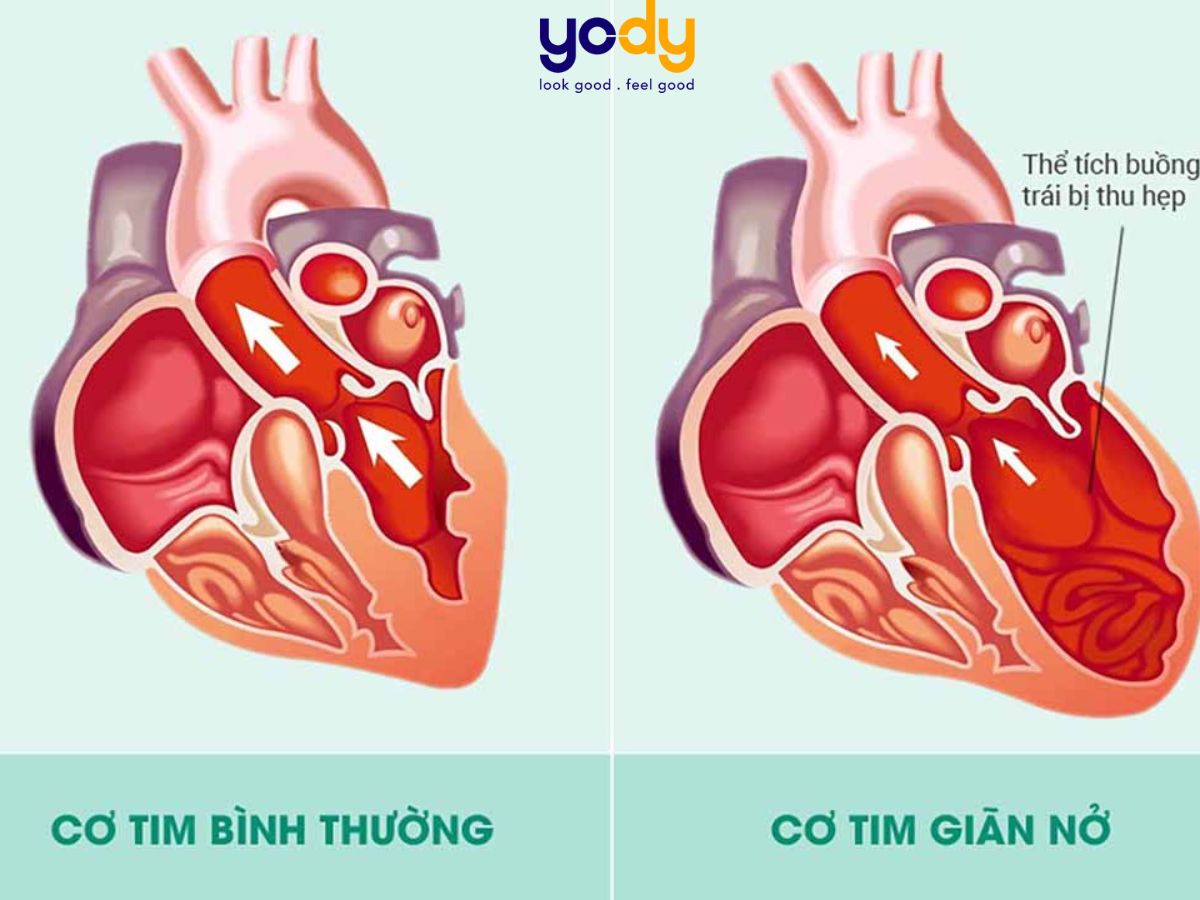 Nhịp tim bình thường là bao nhiêu? Nhịp tim theo độ tuổi với người khỏe mạnh