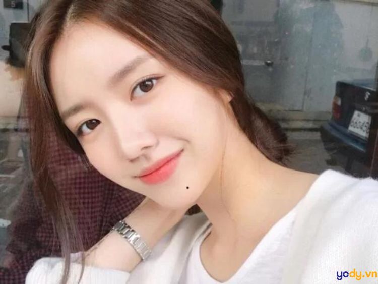 Nốt ruồi ở cằm