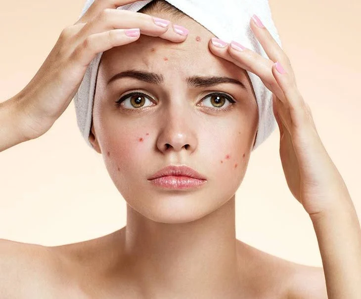 Serum là gì? Cách sử dụng serum đúng cách