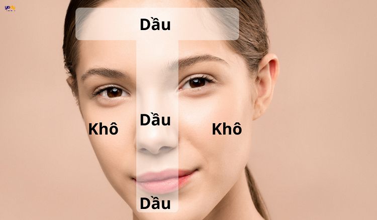 Da hỗn hợp thiên khô là gì?