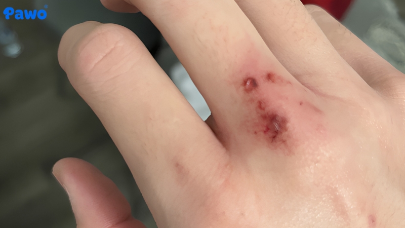 Virus dại lây truyền trực tiếp qua đường nước bọt của con vật mắc bệnh