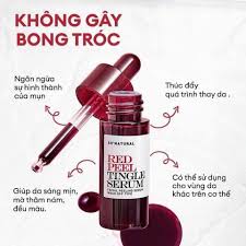 Serum So'Natural Tái Tạo Peel Da Sinh Học 11ml Red Peel Tingle Serum