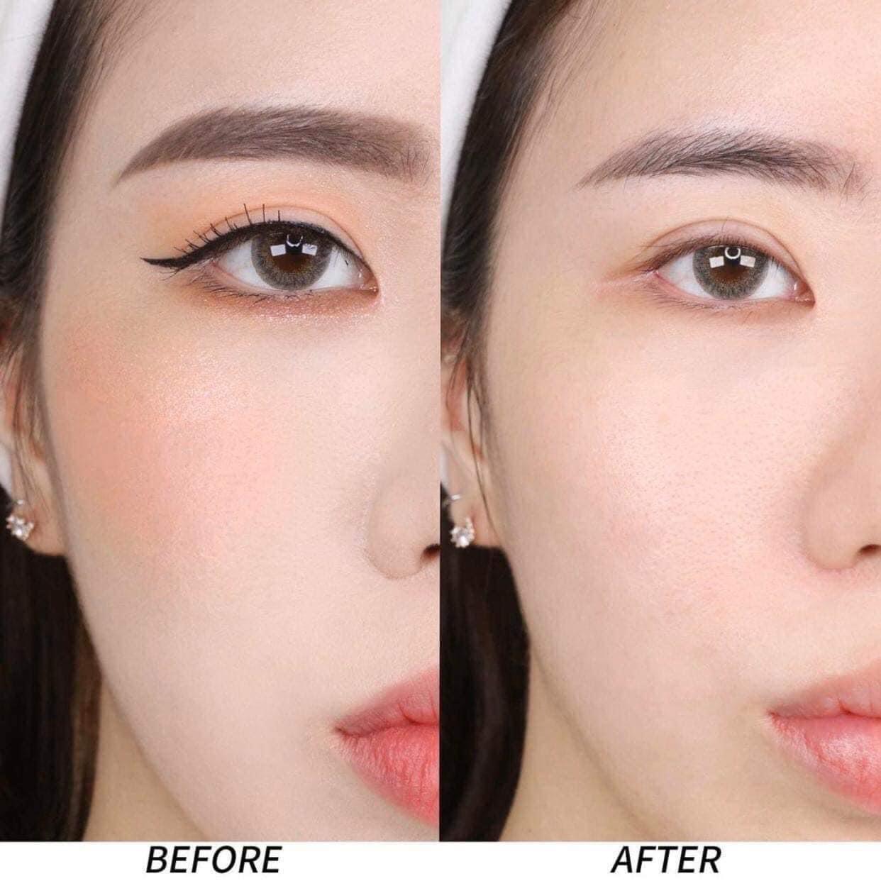 Nước Tẩy Trang Bioderma Dành Cho Da Nhạy Cảm Công Nghệ Micellar Sensibio H2O