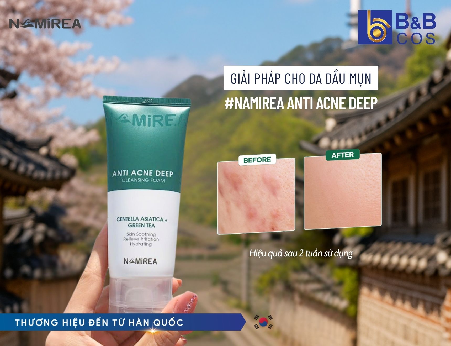 NAMIREA ANTI ACNE DEEP CLEANSING FOAM – Giải pháp làm sạch da chuẩn Hàn, cho làn da trong trẻo như sương mai