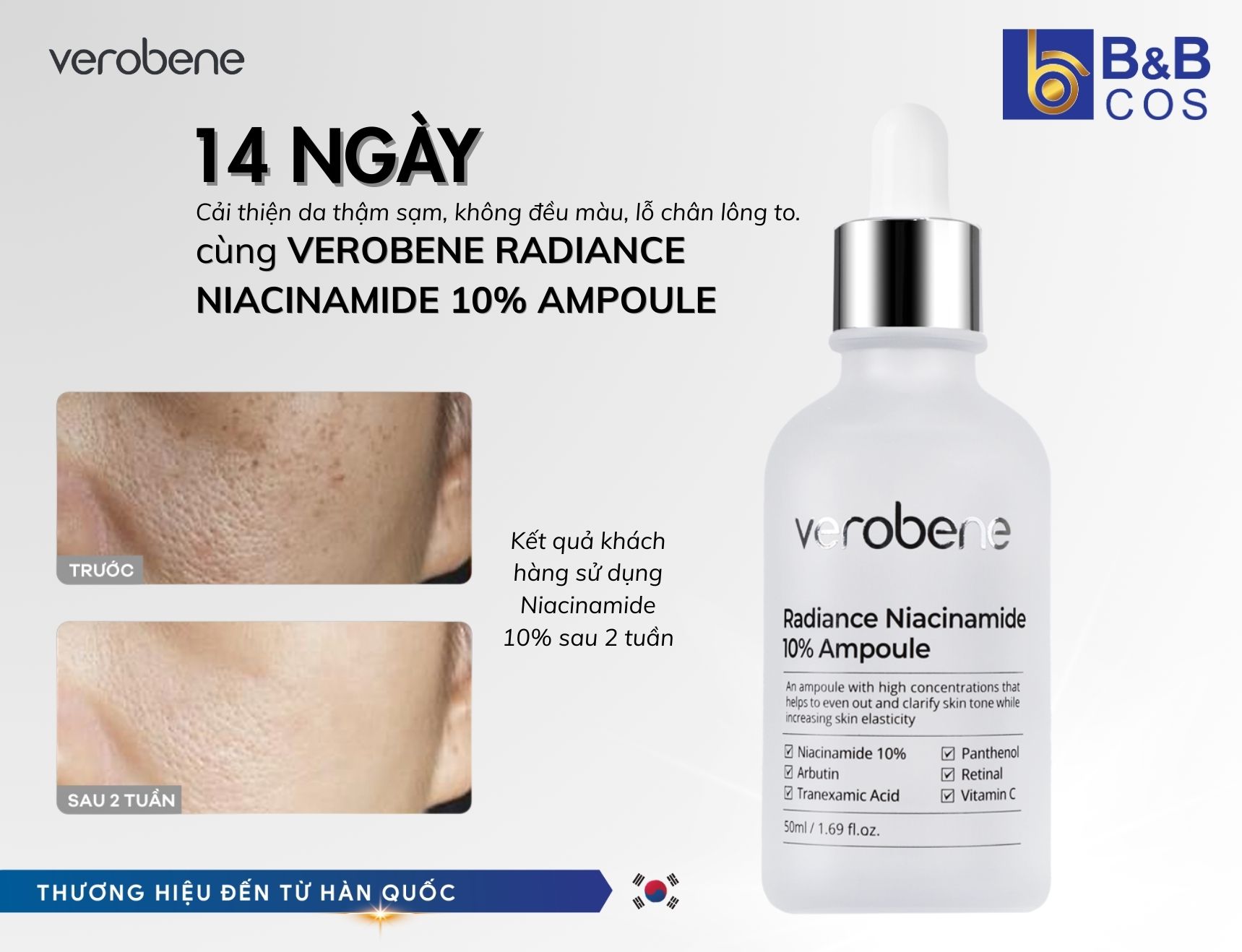 14 NGÀY – CẢI THIỆN DA THÂM SẠM, KHÔNG ĐỀU MÀU, LỖ CHÂN LÔNG TO! Cùng Verobene Radiance Niacinamide 10% Ampoule