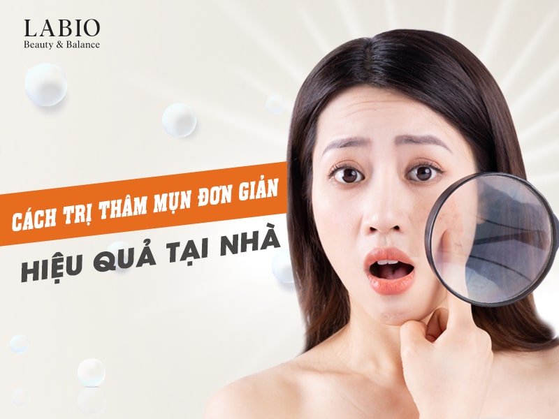 Bật Mí Cách Trị Thâm Mụn Đơn Giản, Hiệu Quả Tại Nhà