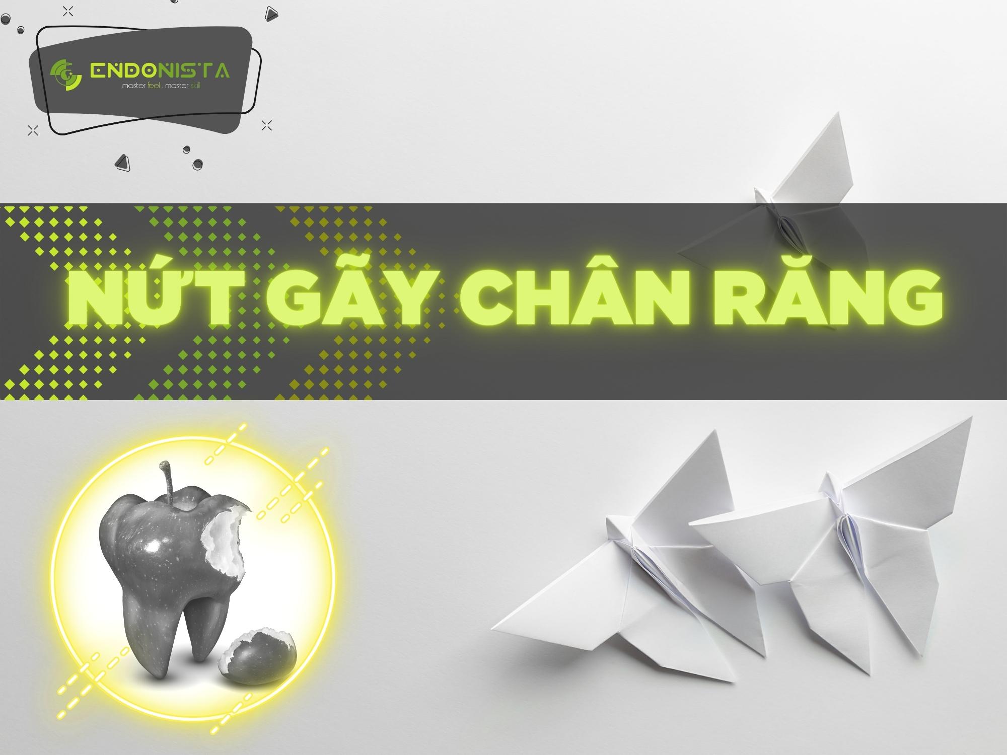 TÌNH TRẠNG NỨT GÃY CHÂN RĂNG