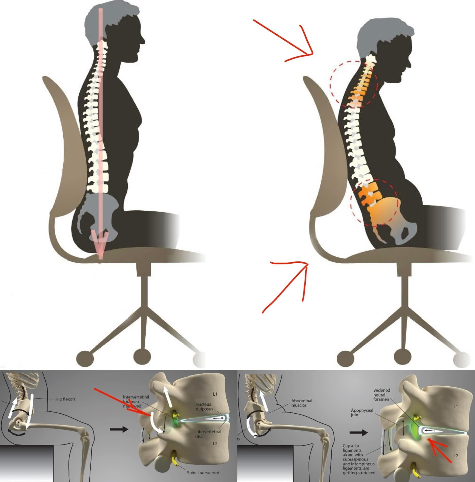 Tư thế ngồi quan trọng thế nào?