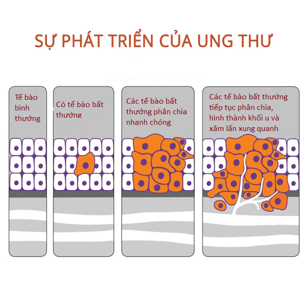 Ung thư là gì?