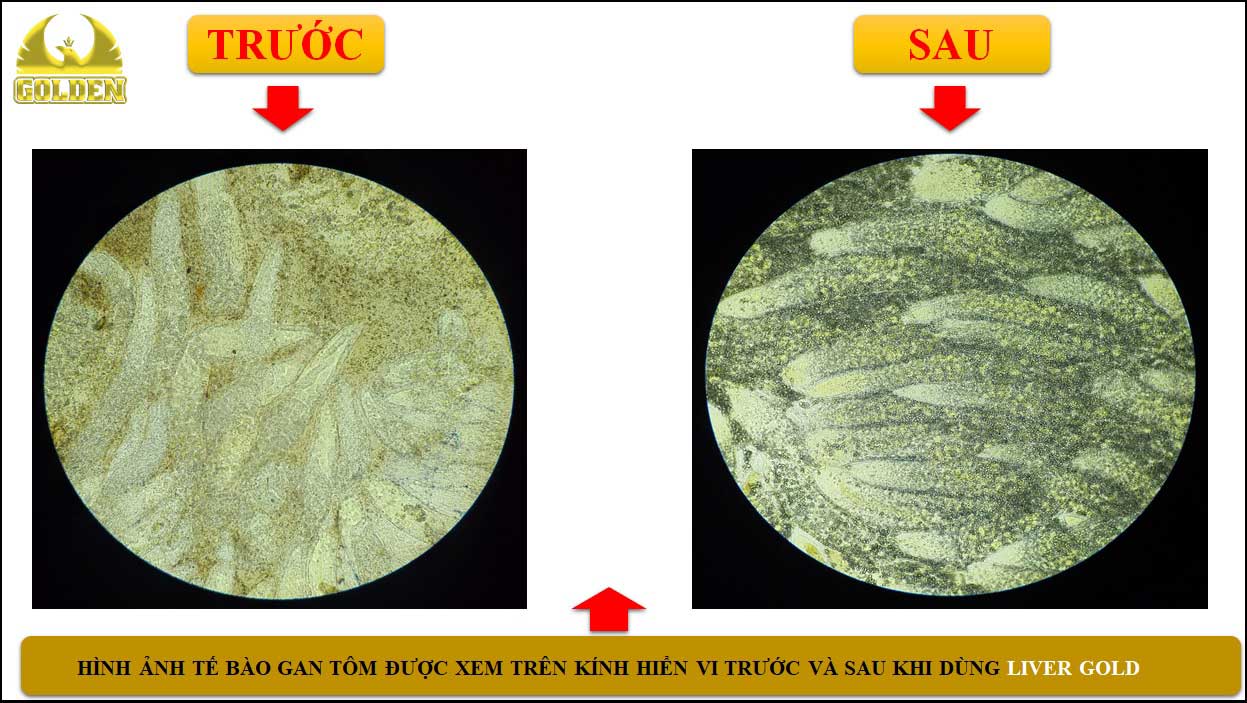 Bộ máy Golgi  Wikipedia tiếng Việt