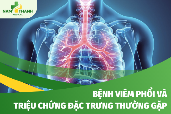 Bệnh viêm phổi và những triệu chứng đặc trưng thường gặp