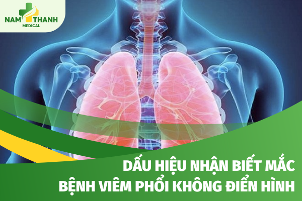 Dấu hiệu nhận biết mắc bệnh viêm phổi không điển hình và cách chữa trị