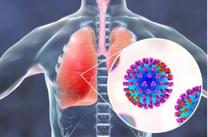 Những điều cần biết về virus viêm phổi trung quốc