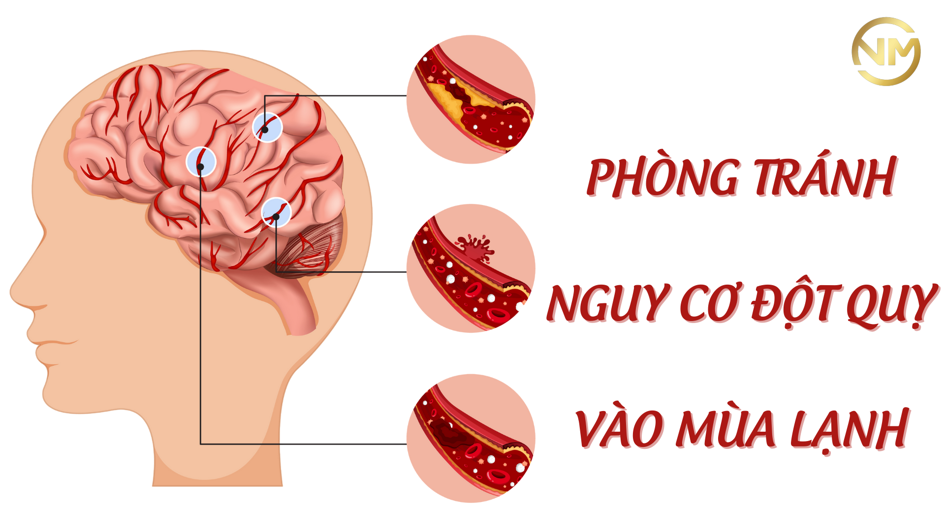 PHÒNG TRÁNH NGUY CƠ ĐỘT QUỴ VÀO MÙA LẠNH