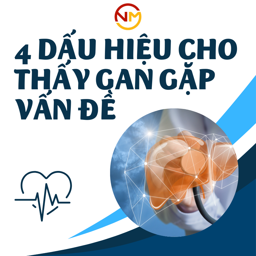 4 Dấu Hiệu Cho Thấy Gan Gặp Vấn Đề: Cách Nhận Biết Sớm Và Đề Phòng