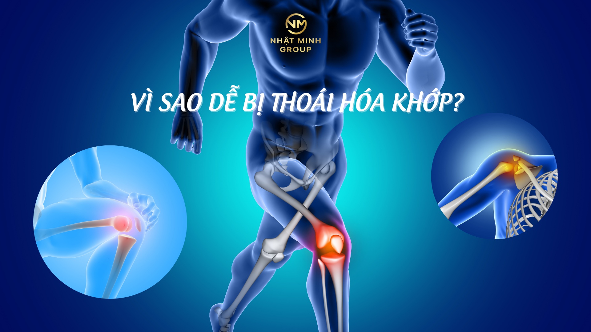 VÌ SAO DỄ BỊ THOÁI HÓA KHỚP?
