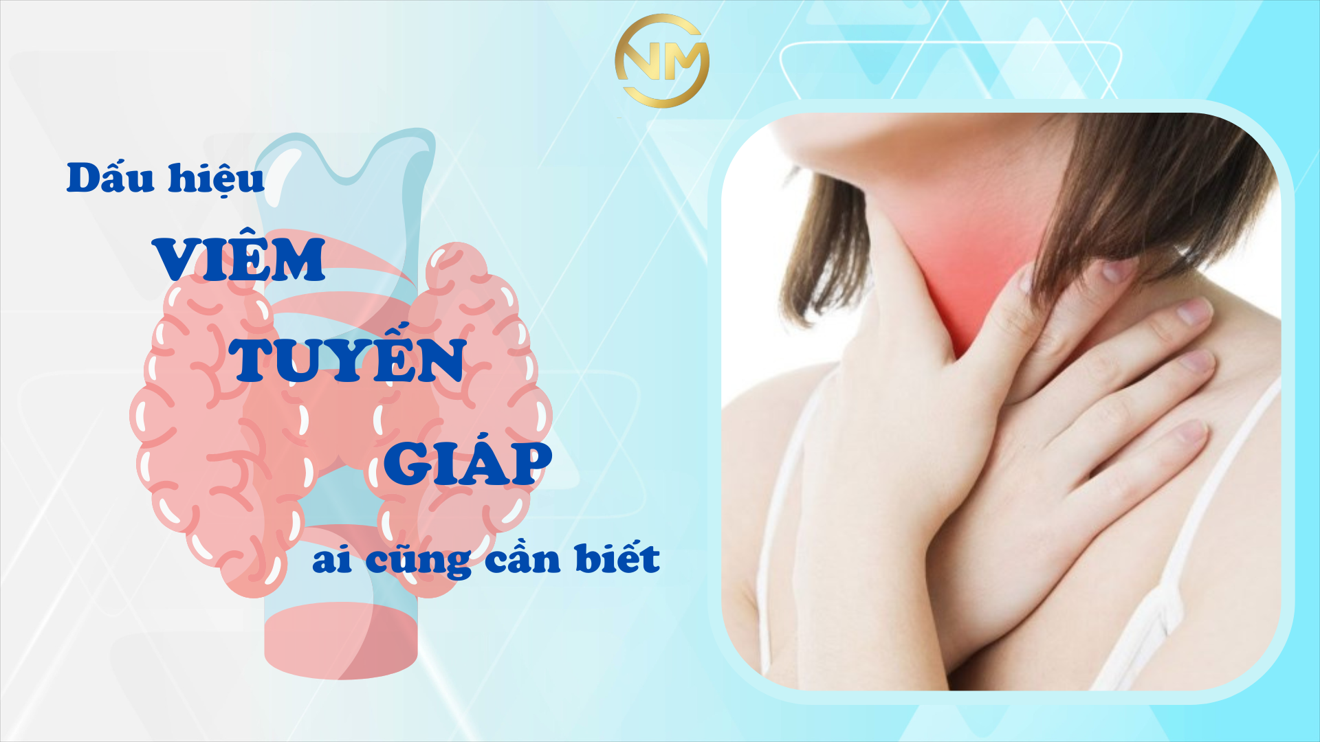 DẤU HIỆU VIÊM TUYẾN GIÁP AI CŨNG CẦN BIẾT