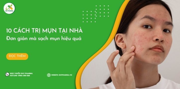 10 cách trị mụn tại nhà đơn giản mà hiệu quả nhất hiện nay