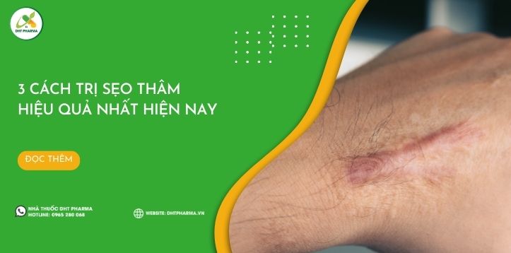 Tìm hiểu 3 cách trị sẹo thâm hiệu quả nhất hiện nay