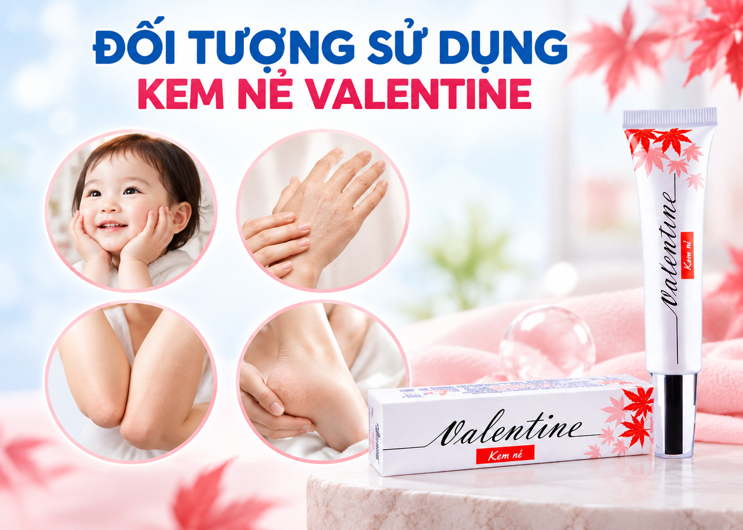 Kem nẻ Valentine