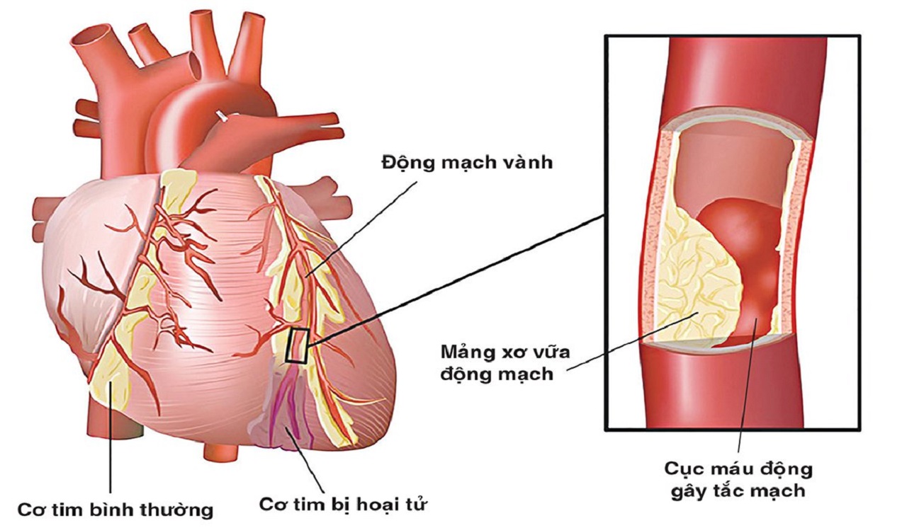 Viên Uống Giảm Mỡ Máu Cholesterol Hisamitsu Nhật Bản