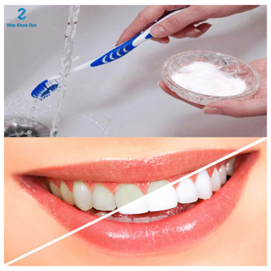 Bột Baking Soda 454g ZA03