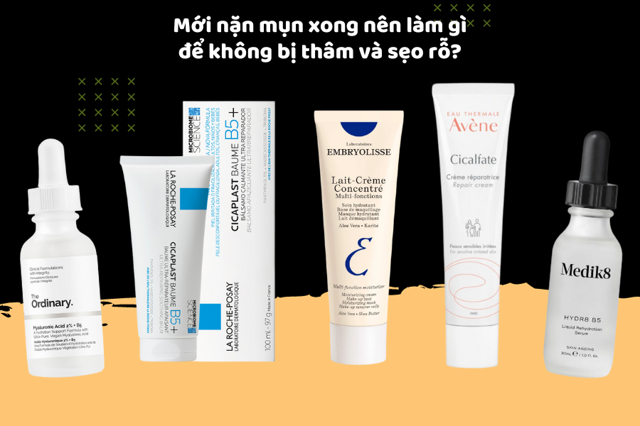 Mới nặn mụn xong nên làm gì để không bị thâm và sẹo rỗ?