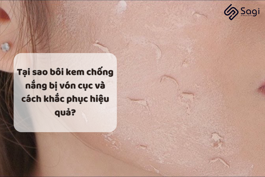 Tại sao bôi kem chống nắng bị vón cục và cách khắc phục hiệu quả?