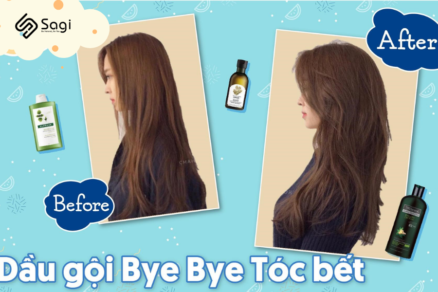 Top 5 cặp gội xã không thể bỏ qua vào mùa hè dành cho các nàng tóc dầu