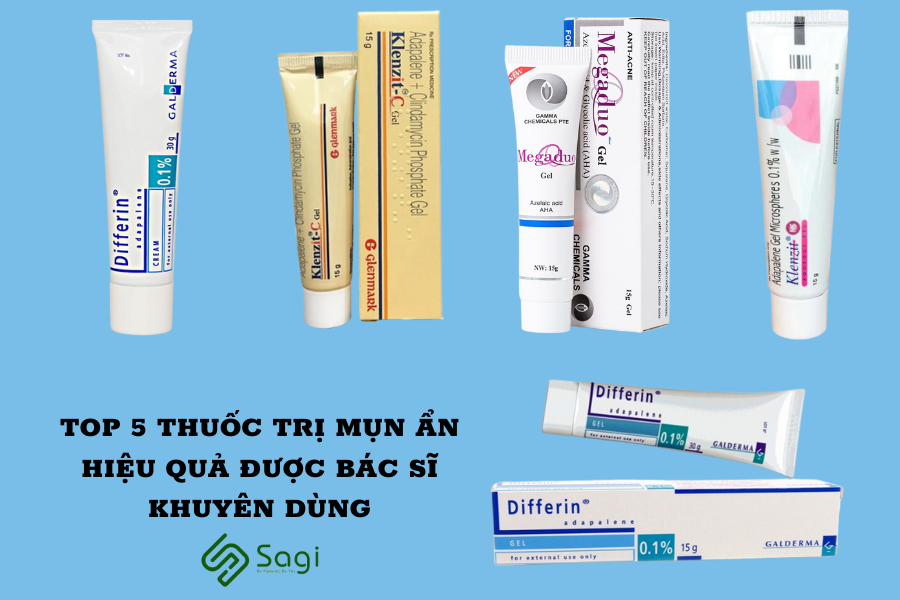 TOP 5 THUỐC TRỊ MỤN ẨN HIỆU QUẢ ĐƯỢC BÁC SĨ KHUYÊN DÙNG