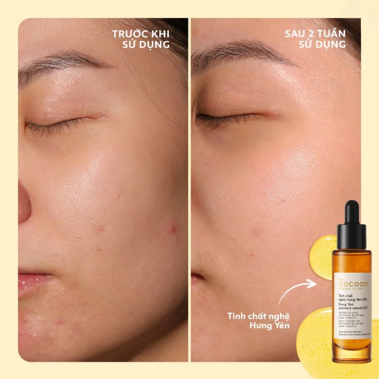 COCOON. Serum Nghệ Hưng Yên C10 30ml