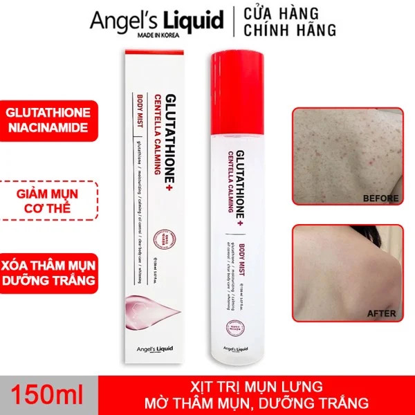 Xịt Giảm Mụn Lưng Angel's Liquid