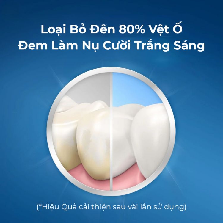 Crest 3D. Dán Trắng Răng Sensitive Gentle