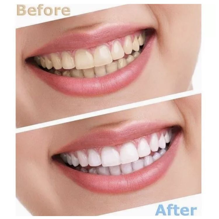 Crest 3D. Dán Trắng Răng Sensitive Gentle