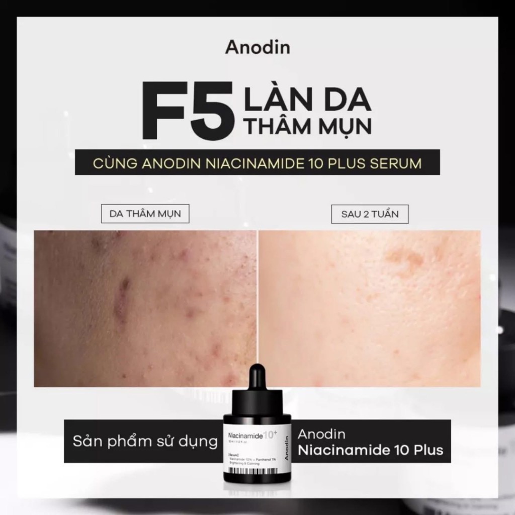 Serum làm trắng và thu nhỏ lỗ chân lông Anodin Niacinamide 10 Plus 33ml