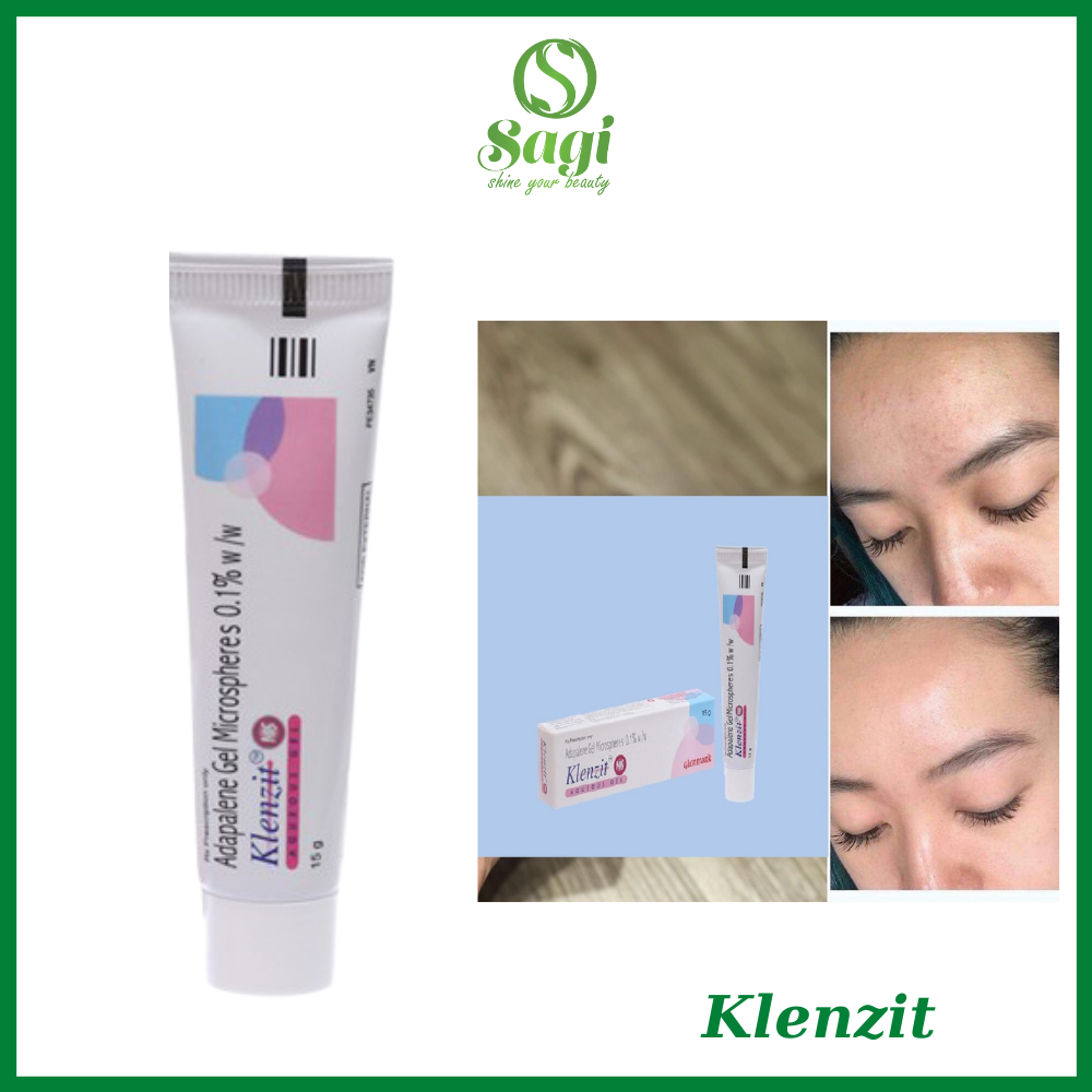 Kem Trị Mụn Klenzit MS 15g