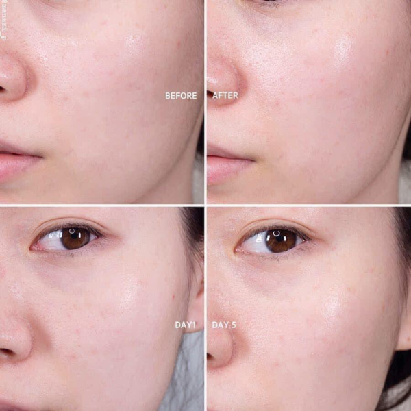 Kem Dưỡng Da Chống Lão Hóa Estee Lauder Revitalizing Supreme+ 15ml (no box)