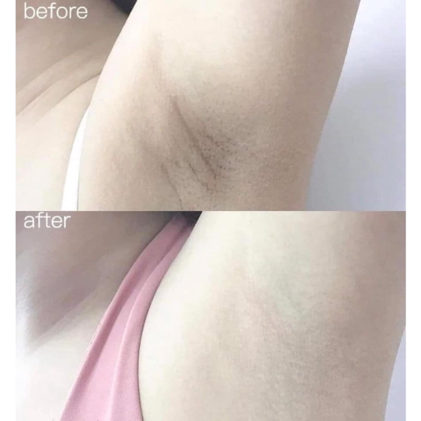 Kem Dưỡng Trị Thâm Nách Body Alpha Arbutin 3plus Organic 50g