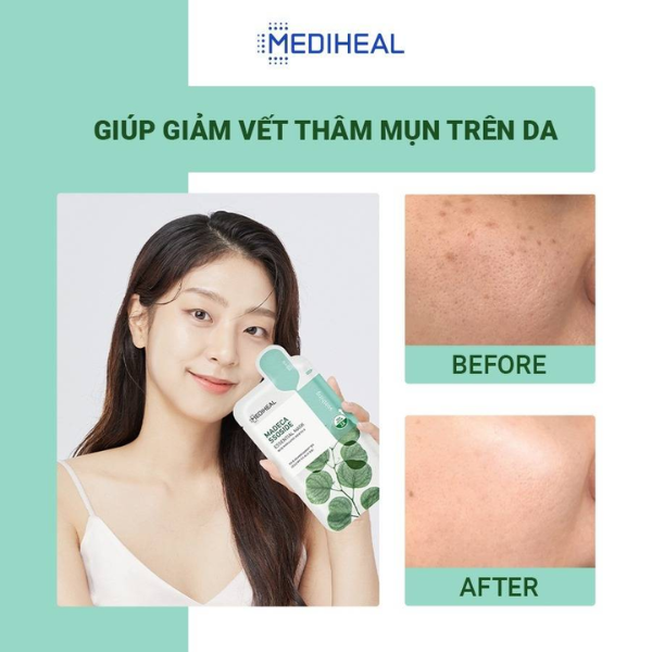 Mặt Nạ Chiết Xuất Rau Má Da Nhạy cảm Madecassoside Essential Mask 24ml