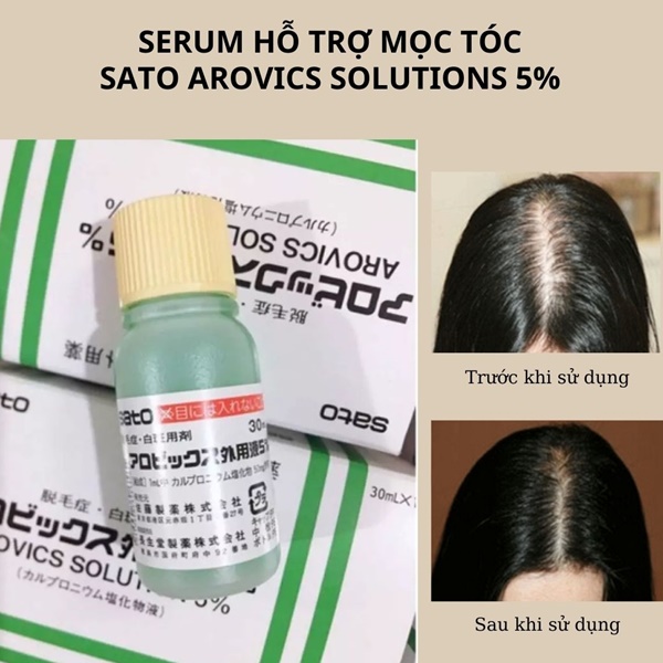 Serum kích thích mọc tóc Sato Arovics Solutions 5%