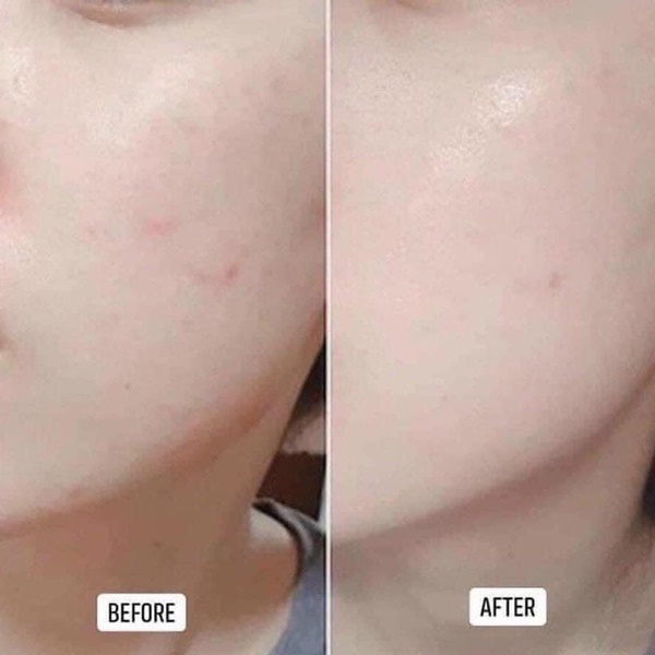 SRM SVR Sebiaclear 400ml (mẫu mới)